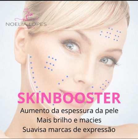 O skinbooster é um tratamento que promove uma hidratação profunda da pele, causando assim um rejuvenescimento de dentro para fora, com isto a pele se regenera, pois o tempo e exposição acumulada ao sol causa envelhecimento. Este procedimento melhora a elasticidade da pele e trazendo novamente um aspecto mais jovem, fresco e natural. O ácido hialurônico, que é utilizado nesse tratamento, é um componente natural e abundante da nossa pele que restaura e mantém o equilíbrio hídrico, melhorando a elasticidade e estrutura da pele envelhecida.
Geralmente são necessárias de 1 a 3 sessões e sua duração é de aproximadamente 1 ano. .
Agende uma avaliação para tirar suas dúvidas 😍