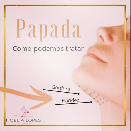 A papada, também conhecida como “queixo duplo”, pode ser gerada pelo acúmulo de gordura, flacidez ou os dois fatores combinados. O rosto pode ficar com um aspecto envelhecido e flácido.
Os resultados da lipo de papada enzimática não cirúrgica podem ser visualizados desde a primeira sessão, após o local desinchar.
O inchaço no primeiro dias pós-procedimento é normal. Dessa forma, para melhorar a situação, pode ser feita a aplicação de gelo na área e repouso, se possível.
Em nosso espaço tratamos de diversas formas:
❇️Mesoterapia: consiste na aplicação de injeções de com sustâncias drenantes, lipolíticas e reafirmantes, sendo necessária de 3 à 8 sessões
❇️Hidrolipoclasia não aspirativa, aplicação de soro seguido de ultrassom.
❇️Além do uso de eletroterapia, como laser, radio frequência, criofrequencia.
Na avaliação será decido qual é a melhor técnica a ser utilizada.
Agende uma avaliação para entender melhor como se dá este processo.