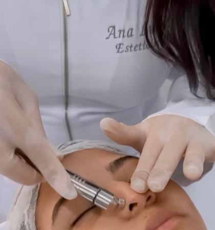 O Peeling de Diamante é um tratamento estético para remover as camadas superficiais da pele, promovendo a renovação da pele e estimulando a produção de colágeno.
Você terá uma melhora na redução de manchas, rugas, cicatrizes e poros dilatados, além de deixar a pele mais macia, luminosa e uniforme.
É um tratamento bastante confortável para os pacientes. Além disso, a recuperação é rápida e não exige tempo de afastamento das atividades cotidianas, sendo uma ótima opção para quem deseja cuidar da pele de forma prática e eficiente.
Chame no Whatsapp ou cadastre-se no formulário!